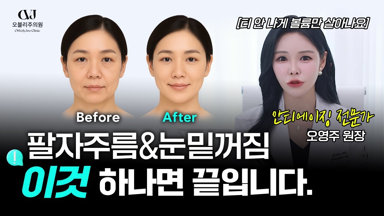 꺼진 곳은 채우고, 처진 곳은 올린다! 티 안 나는 자연스러운 변신! 잼버실 시술 총정리