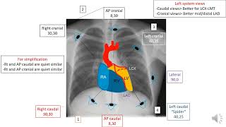 How to read  a coronary angiography