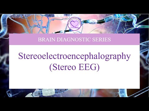 Stereoelectroencephalography (Stereo EEG)