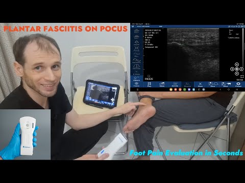 Plantar fascia · POCUS · D3Ultra · Linear probe scan preview