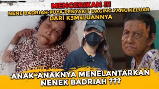 NENEK BADRIAH NENEK YANG DITELANTARKAN ANAK-ANAKNYA? MENGIDAP P3NY4KIT D4GING YANG KELUAR DARI v NYA