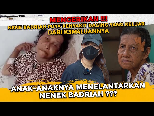 NENEK BADRIAH NENEK YANG DITELANTARKAN ANAK-ANAKNYA? MENGIDAP P3NY4KIT D4GING YANG KELUAR DARI v NYA class=