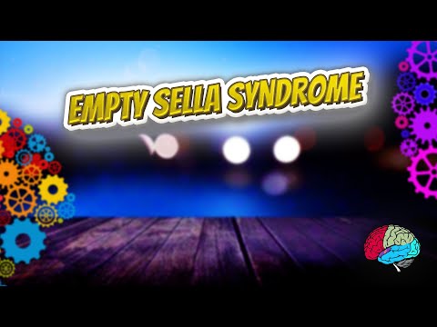 एम्प्टी सेला सिंड्रोम - यह सब जानें