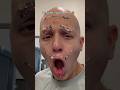 Bedazzling my bald head 👨🏽🦲✨ #comedy #funny #lol #alopecia