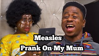 MEASLES PRANK | Mc Shem Comedian