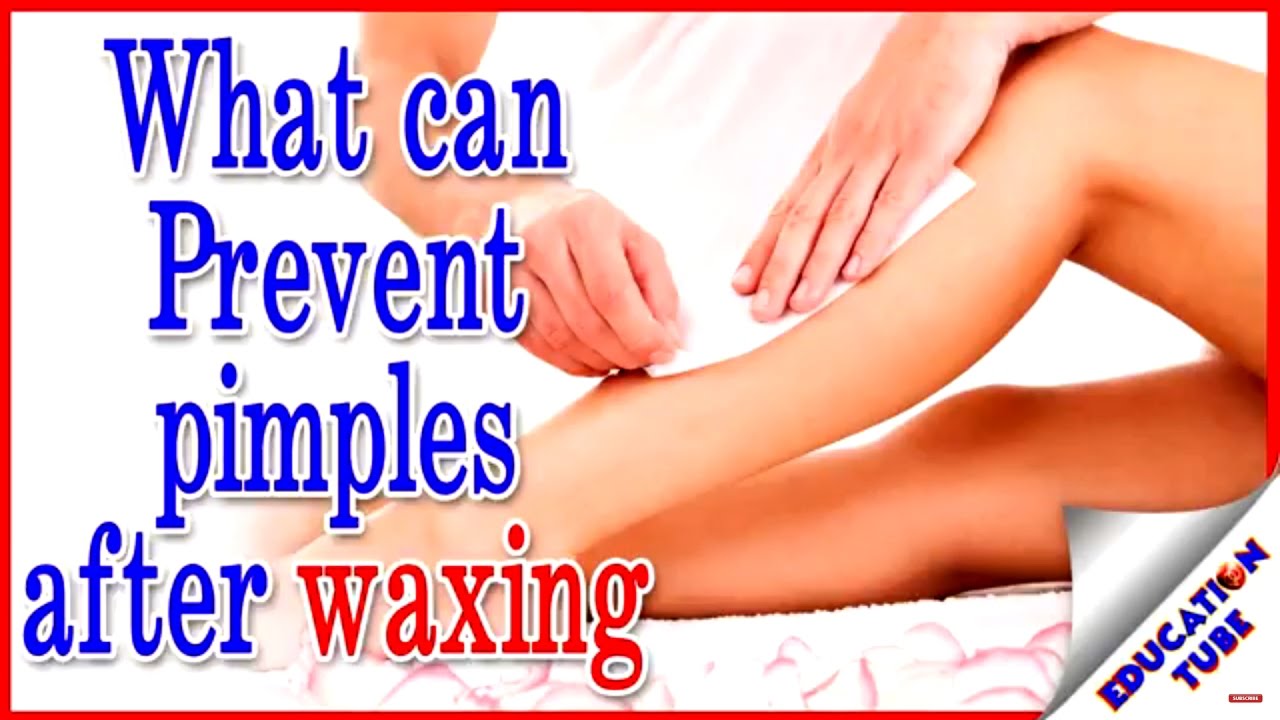  After Waxing Pimples YouTube