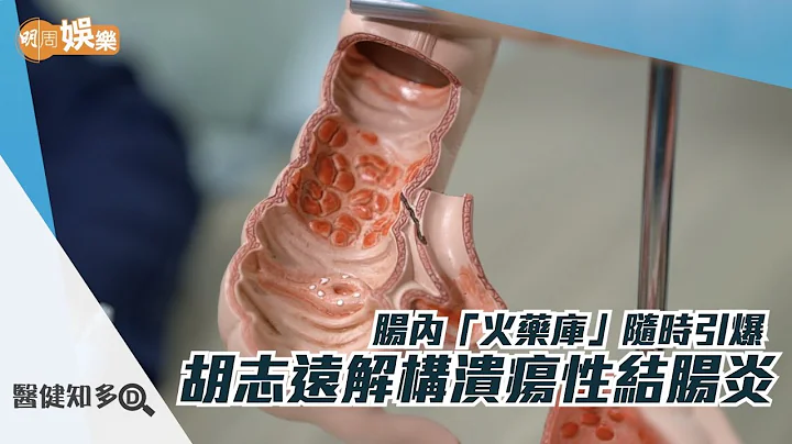 【医健知多D】胡志远解构溃疡性结肠炎 - 天天要闻