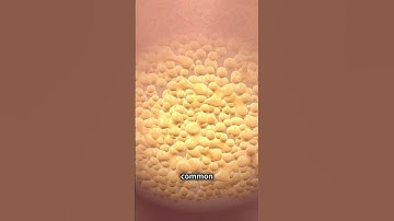 The Secret Life of Fat Cells: Adipocytes #science #biology