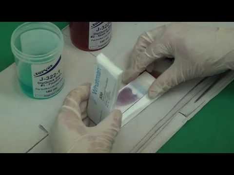 Video: Blutausstrich: Zweck, Verfahren Und Ergebnisse
