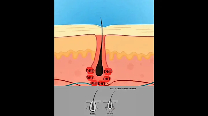 Hair Fall and Regrowth Animation