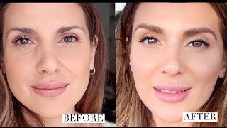 HOW I GOT RID OF UNDER EYE HOLLOWS AND IMPROVED MY OVERALL LOOK |  ALI ANDREEA screenshot 5