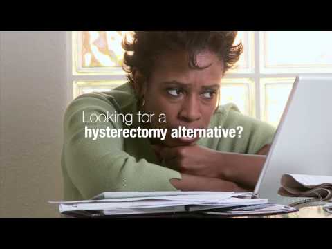 uterine-fibroid-embolization-(ufe)---hysterectomy-alternative