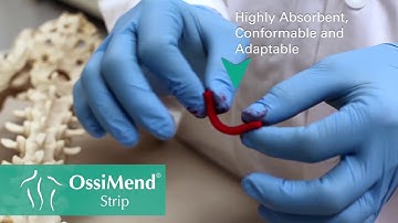 Collagen Matrix - Spine OssiMend® Strips & Pads - Product Demo