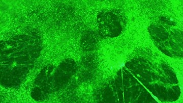 Suppl  video 6 Fluo 8 Ca Imaging 2D day 50 100 frames