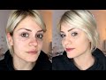 Correggere brufoli e occhiaie | Trucco CORRETTIVO facile | AlicelikeAudrey