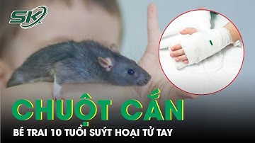Bị chuột cắn bé trai 10 tuổi suýt hoại tử tay, phụ huynh cần biết điều này để bảo vệ con | SKĐS