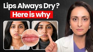 Kya lip balm ke baad bhi lips dry hai?  Best lip balm recommendations | tvacha ke doctor