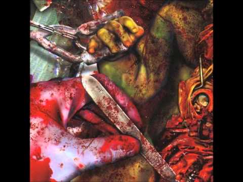 Rot — Antigama - Softer