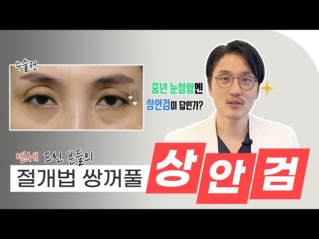 [CN]중년들의 쌍꺼풀수술! 상안검이 답이다