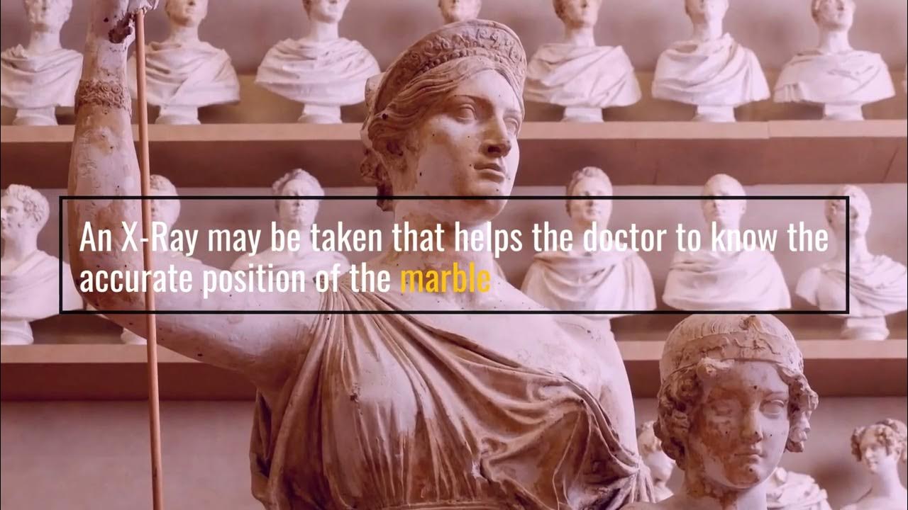 what-happens-if-you-swallow-a-marble-you-won-t-believe-youtube