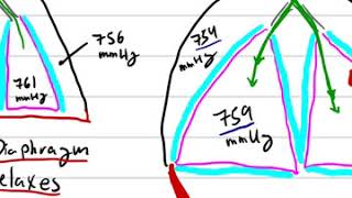 Air flow (Respiratory Systems Pressure Gradients)
