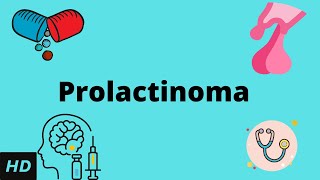 Prolactinoma, Causes, Signs and Symptoms, Diagnosis and Treatment.