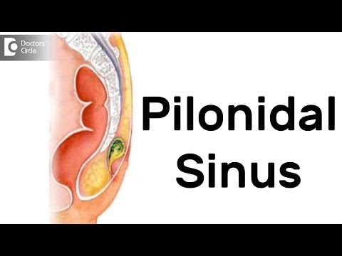 What is Pilonidal Sinus? Symptoms, Diagnosis, Treatment - Dr. Rajasekhar M R