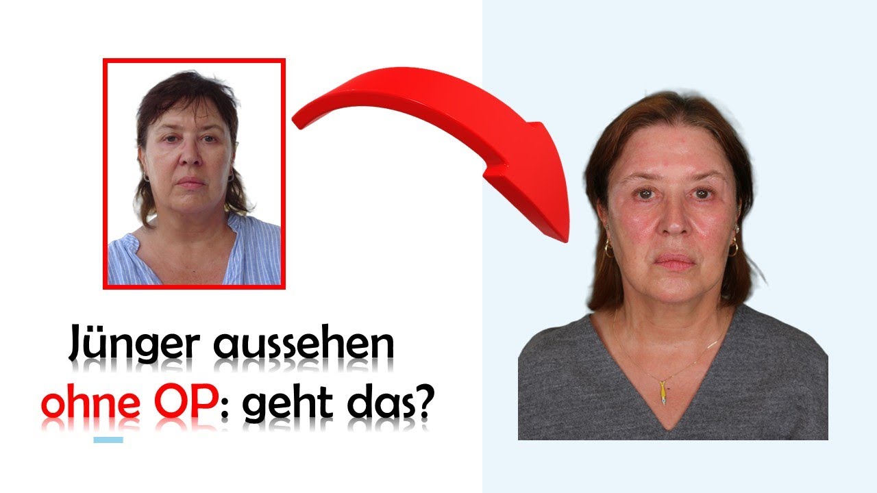 10 Jahre jünger aussehen ohne OP - geht das? - Die BESTEN 5 Tipps die wirklich funktionieren