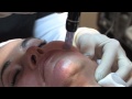 Middle of video