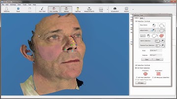 Face lift/Face resculpture 3D simulation - facelift surgery results before cosmetic plastic surgery