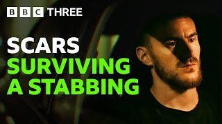 “I Didn’t Want To Speak To Anyone About It” | Surviving A Knife Attack