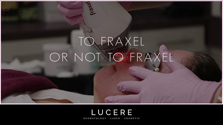 To Fraxel or Not to Fraxel