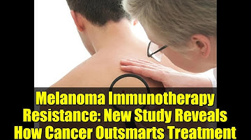 Melanoma Immunotherapy Resistance: New Study Reveals How Cancer Outsmarts Treatment