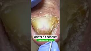 Заказать Микозоцид можно на Wildberries.Артикул - 450824076