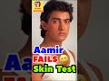 Aamir Fails Skin Test 😜 | Source: Viral Bollywood, Bollywood Hungama &amp; Netflix #satire #rakhisawant