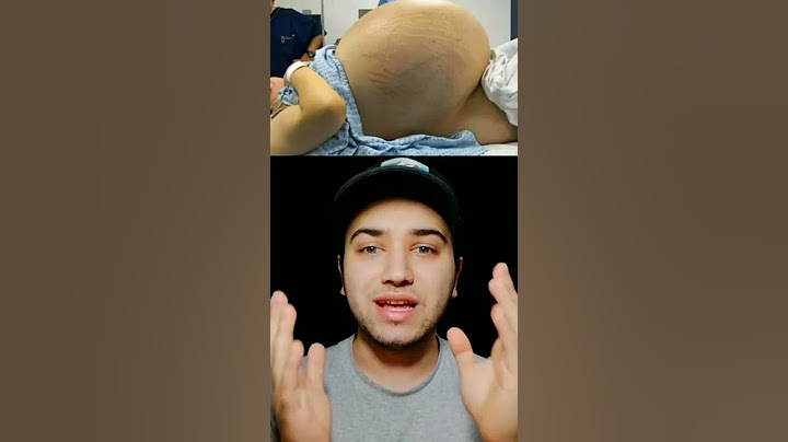 Herkes Bu Kadını Hamile Sanıyordu Fakat... 😱🤯👀