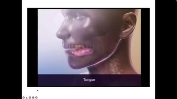 Why do we use texture modified diets?