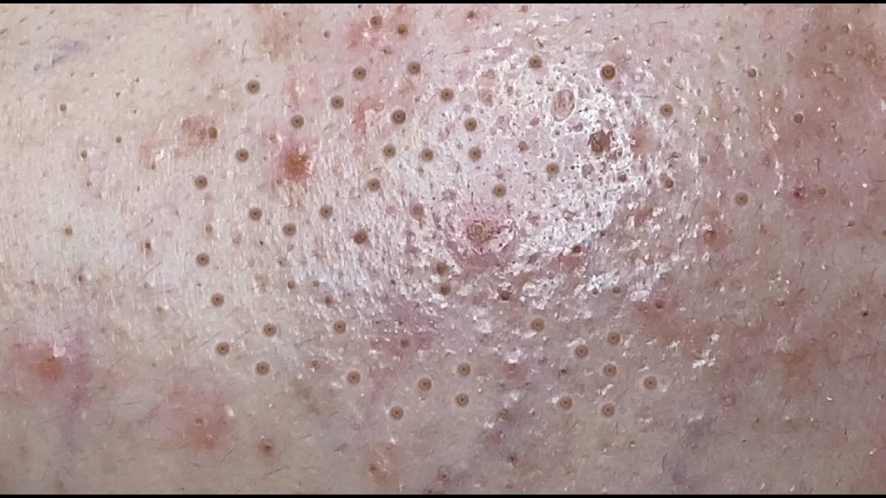 Satisfying Relaxing with Sac Dep Spa Video (#106)