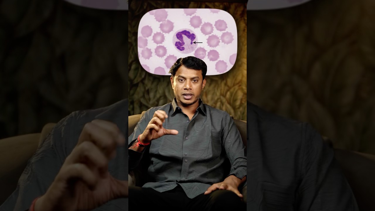 ‼️Parvo virus ‼️ know more! Subscribe! #dogs #parvovirus #doglover #animallover #sick #veterinary