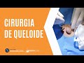 Cirurgia de Queloide (decorrente de pelo encravado)