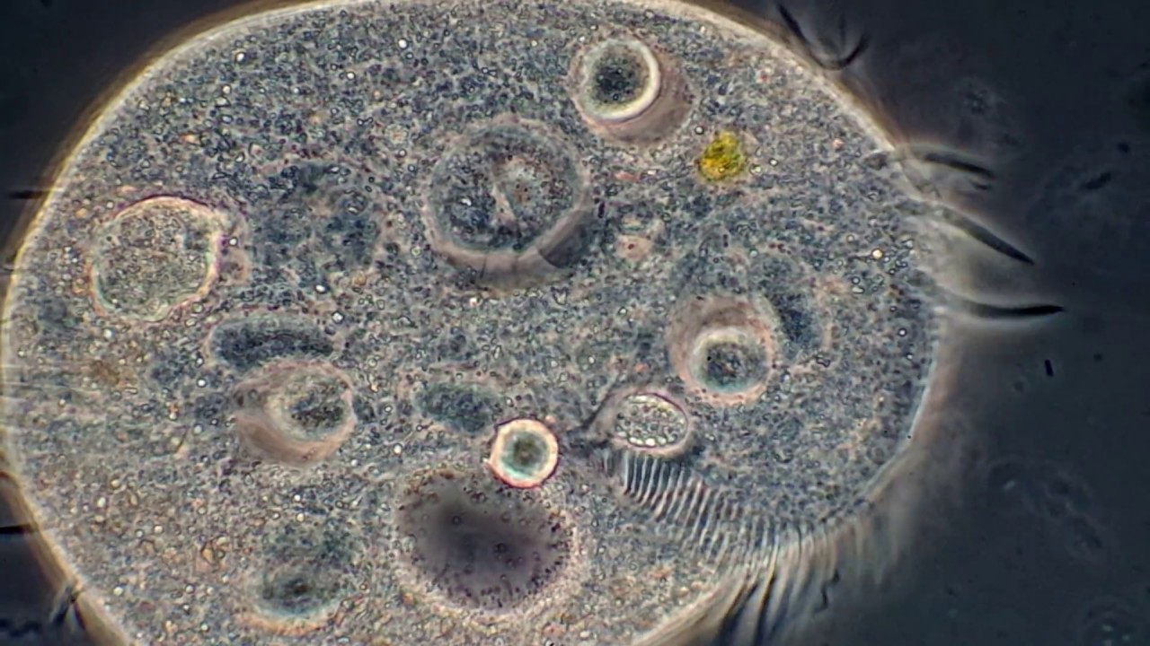 Lauftierchen / Euplotes mit Cilien  aus Heuaufguss