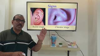 Eczematous otitis externa: (English) Patient teaching programme