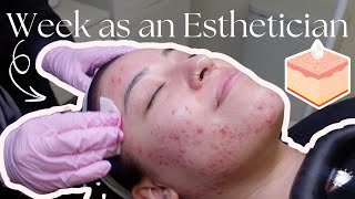 Acne Treatments, Unboxings, & Redecorating The Spa Week As An Esthi Vlog