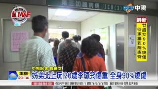 【中視新聞】20歲女90%燒傷嚴重 待家屬到院後拔管20150629