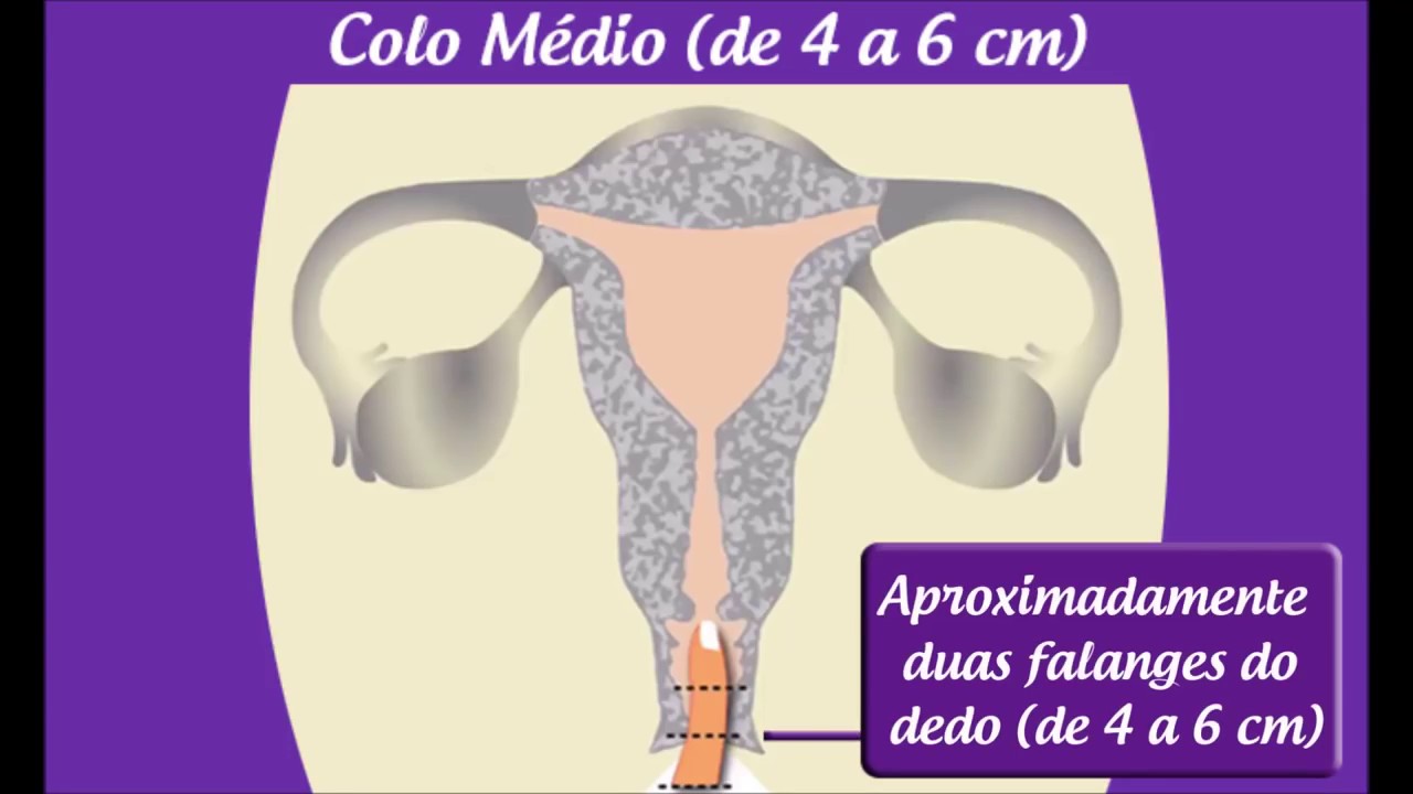 Como Medir O Colo Do útero - ZULEDU