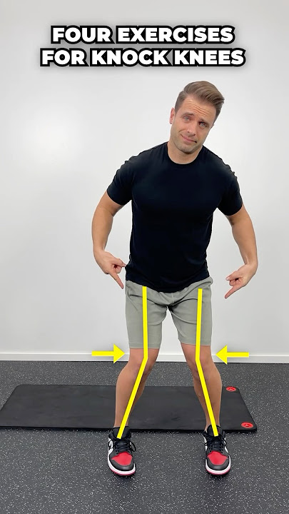 Fix Your Knock Knees! [4 Of The Best Home Exercises For Genu Valgus]