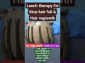 Leech therapy for hair problems