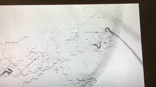Eyelash touch C. elegans