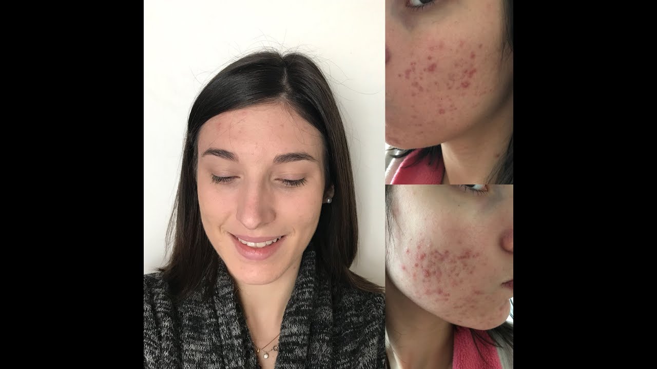 GRESSA SKIN FOND DE TEINT LIQUIDE TEINTE 1,5