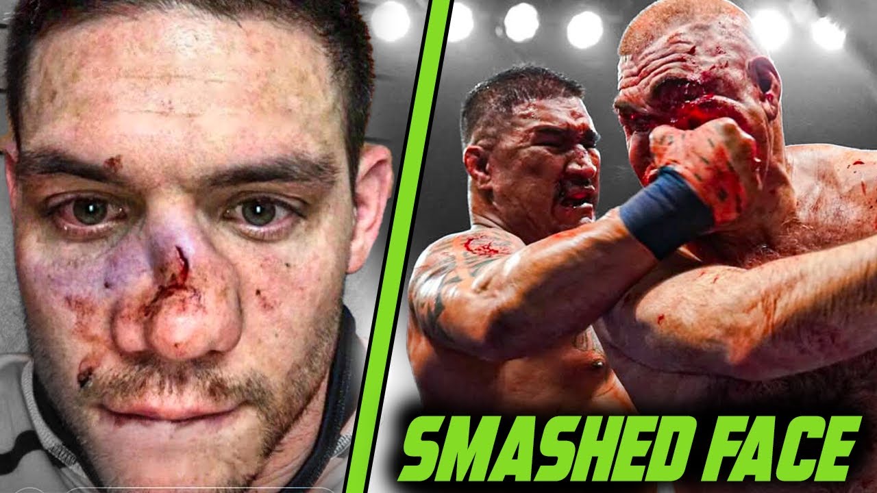 'Blunt force trauma' Punches